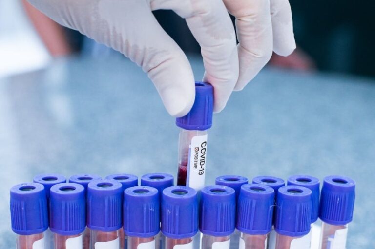Quais são os testes de covid e qual usar em cada situação
