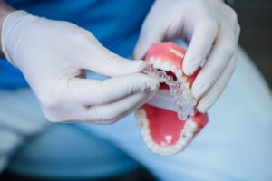 Diferenças entre as próteses dentárias