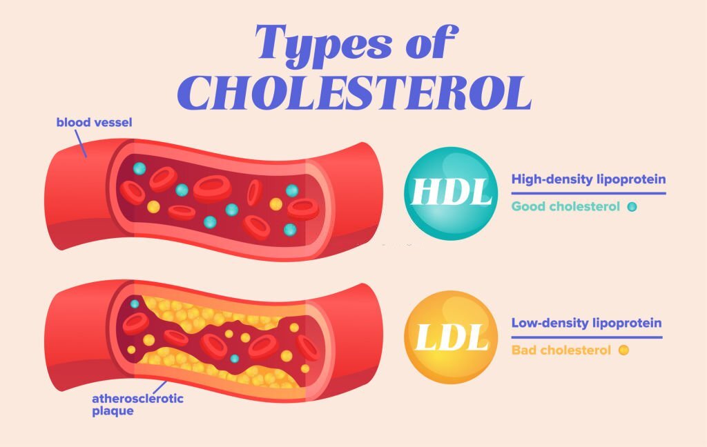 Veja qual a real diferença entre os tipos de colesterol