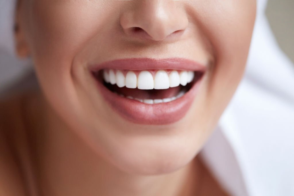 Algumas coisas que você precisa saber sobre clareamento dental