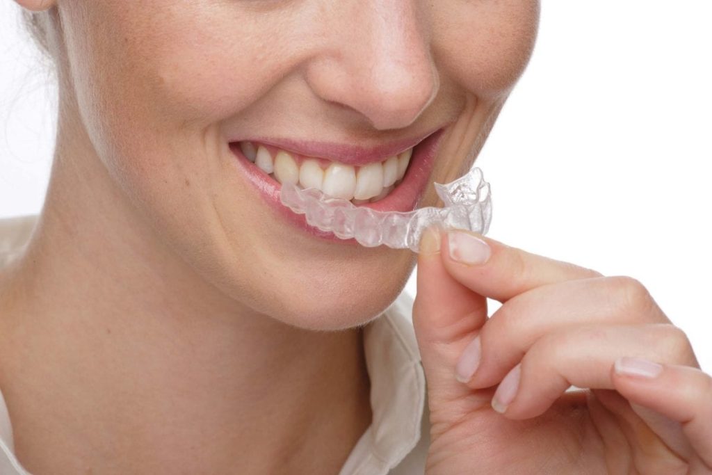 Conheça mais alguns mitos e verdades sobre o clareamento dental