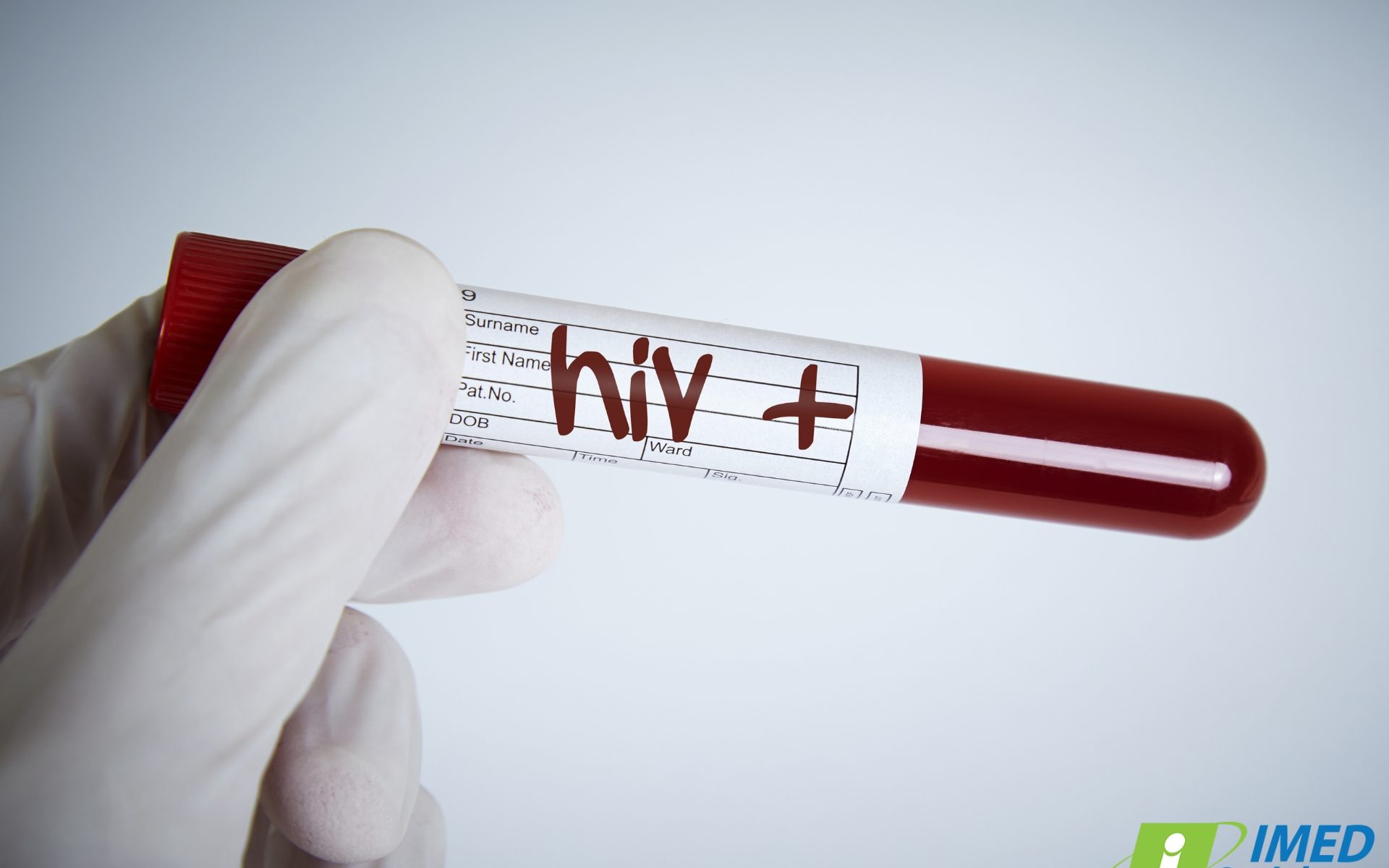 hiv